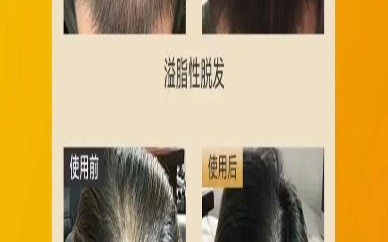 茶枯洗头的功效图片,油茶枯洗头有什么好处