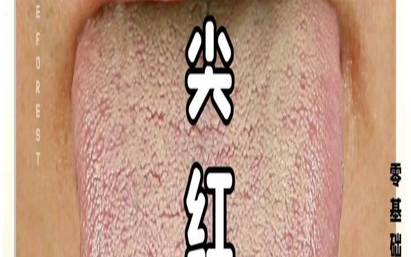 紫梅红是什么颜色,舌头发紫舌尖发红怎么回事
