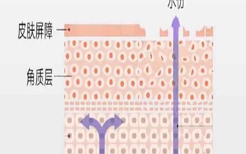 绿茶可以修复皮肤吗,皮肤屏障受损怎么修复